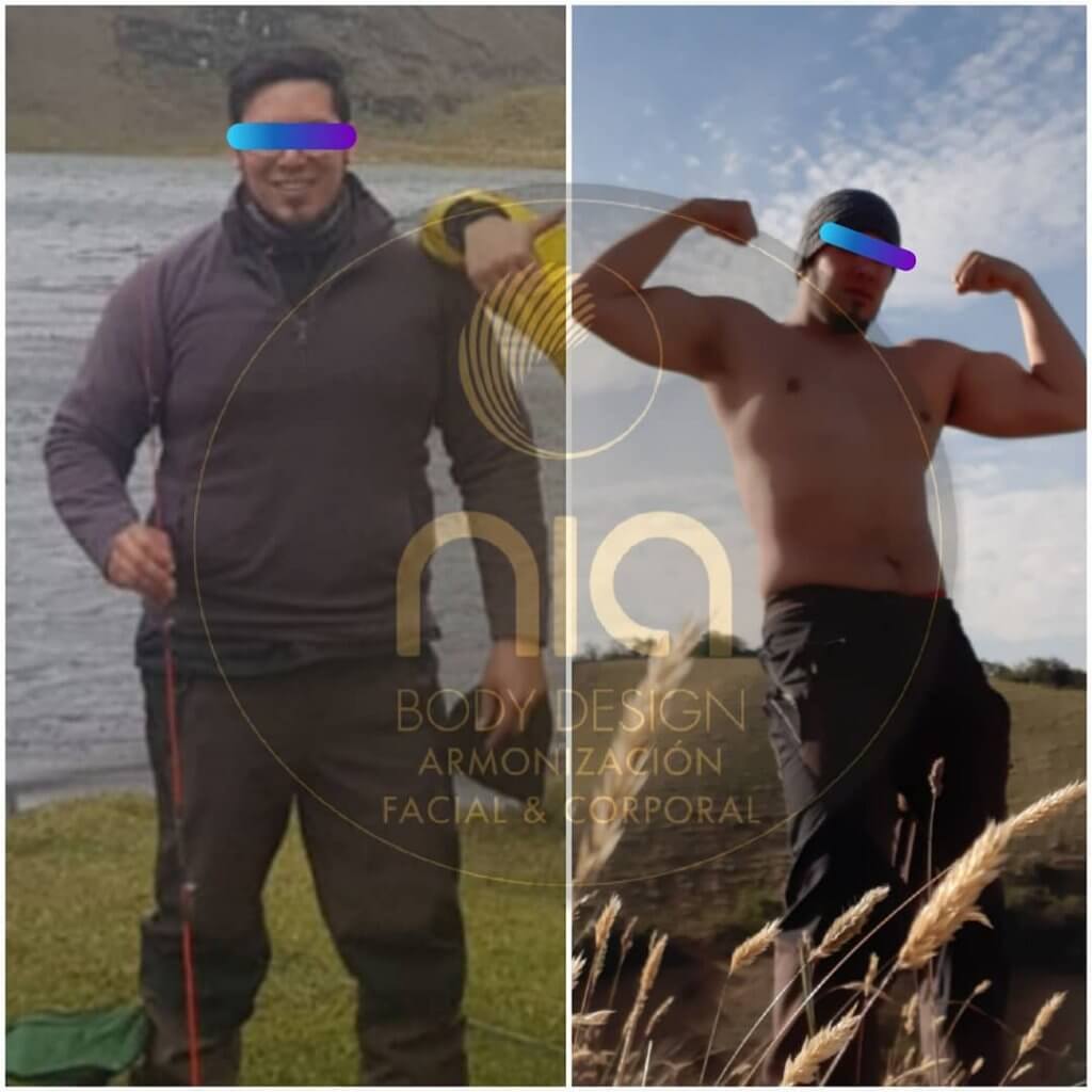 Reducción de Medidas Nia Body