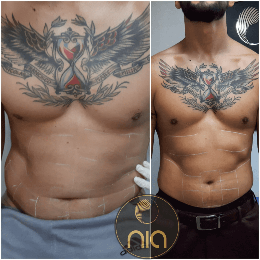 Tonificación de Musculos Nia Body Design