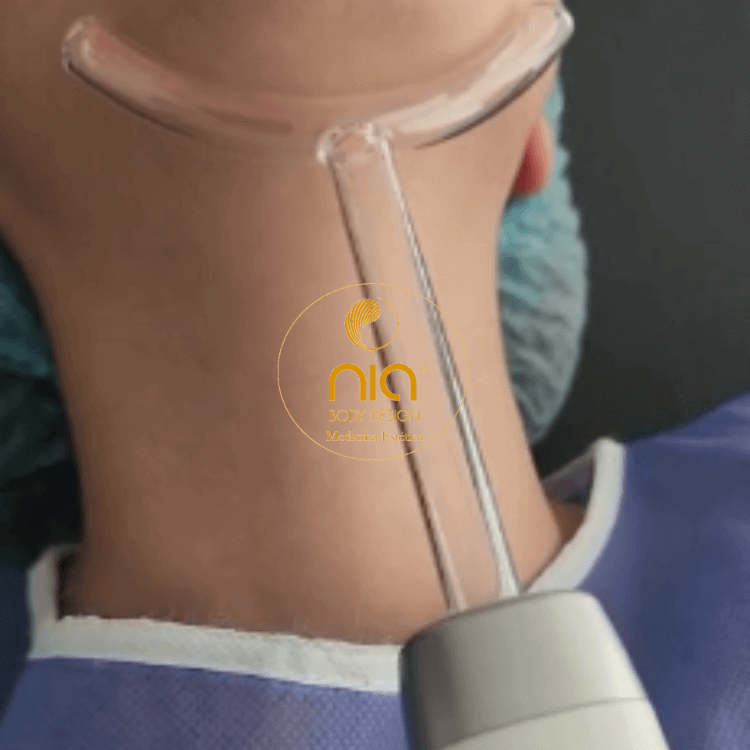 Aplicación del Equipo de Alta Frecuencia