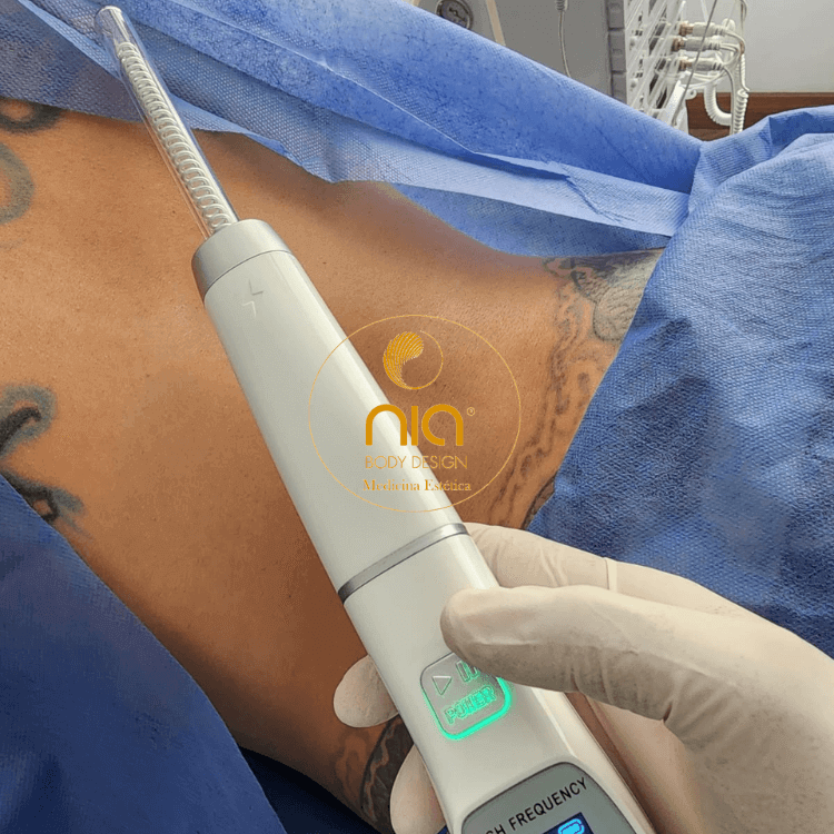 Usos del Equipo de Alta Frecuencia